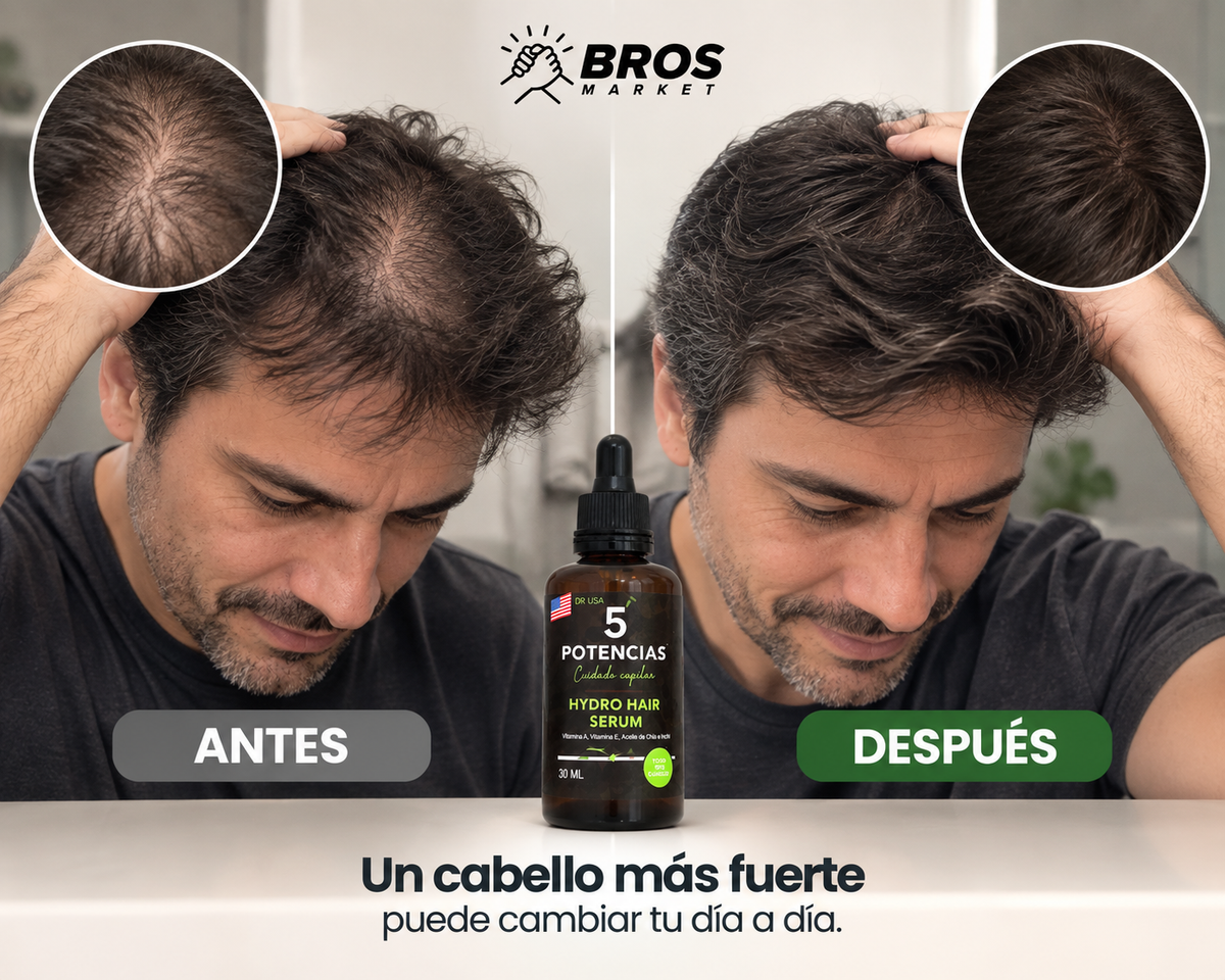 5 Potencias Serum Capilar Anti Caida - Nutrición para un cabello radiante y abundante