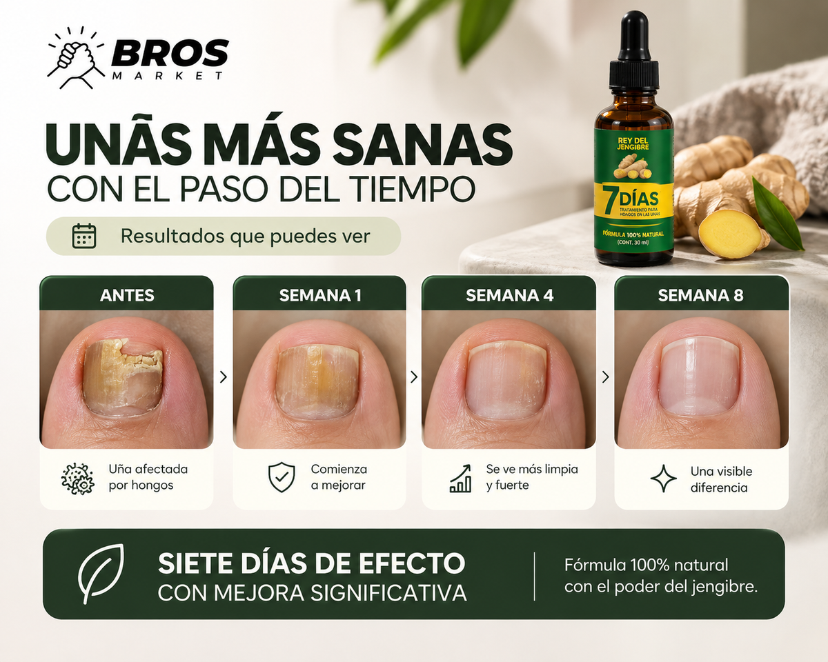 Tónico Antifúngico de Jengibre 7 Days - Uñas más fuertes y cuidadas en cada gota