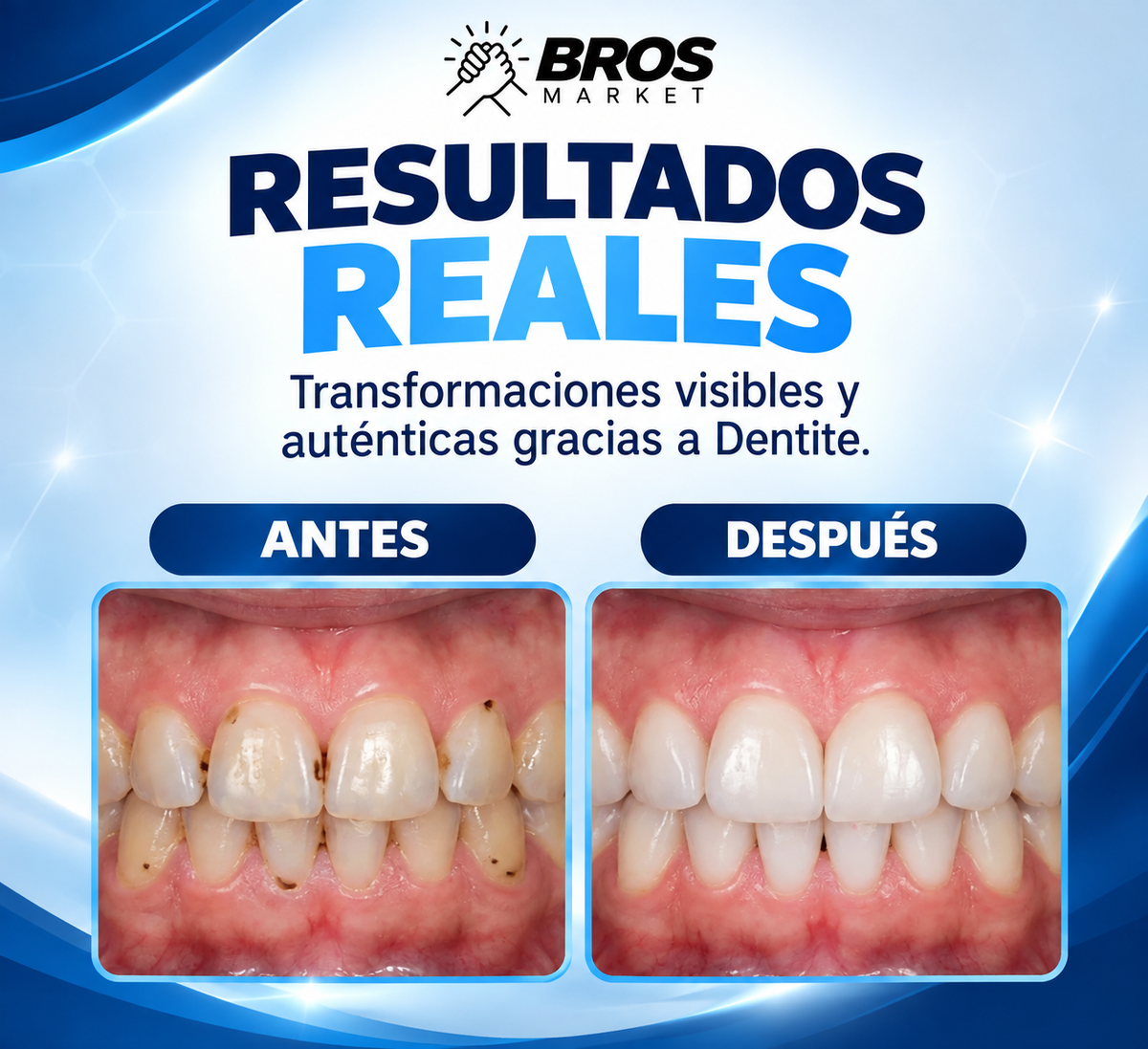 Dentiva Reparador del Esmalte Dental - Fortalece y remineraliza el esmalte