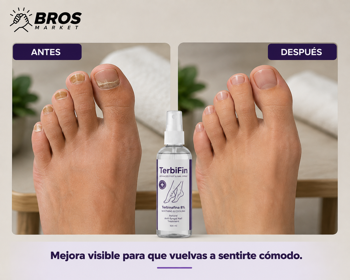 TerbiFin Spray 8% Anti-Hongos - Pies más frescos, uñas mejor cuidadas