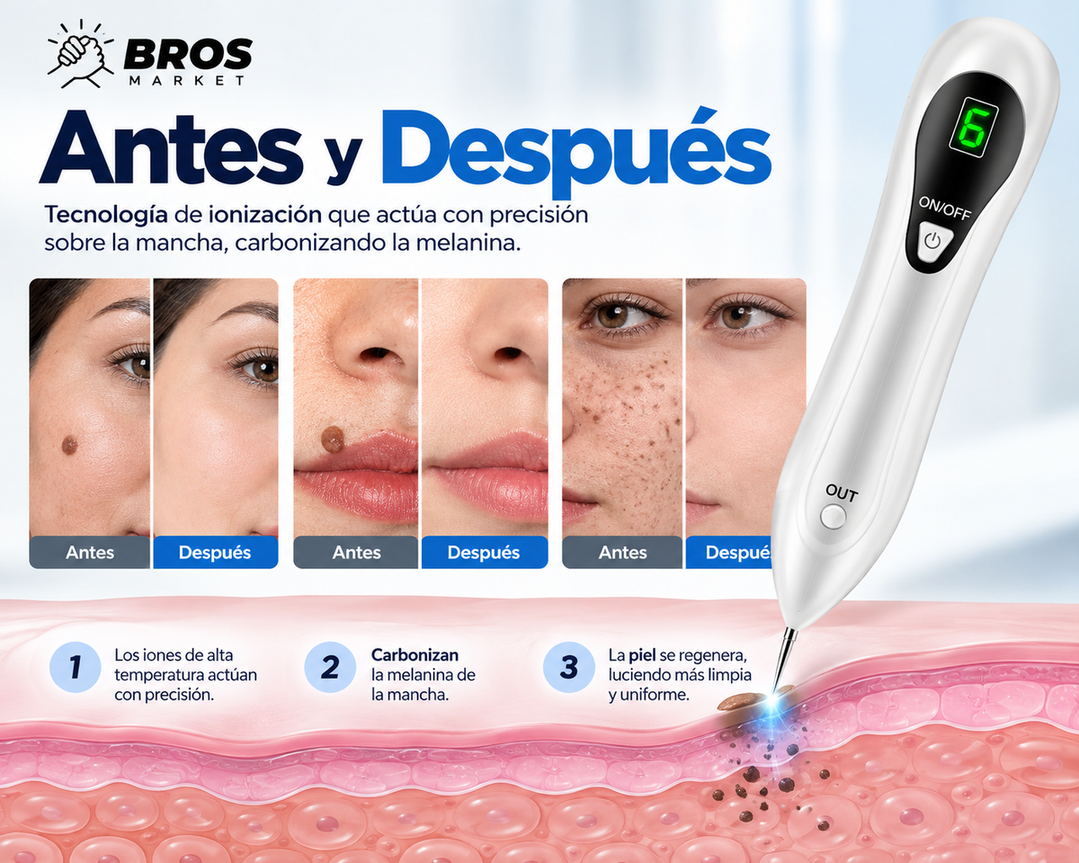 Nevus Pen Lápiz Cauterizador Quita Verrugas y Lunares - Precisión para cuidar tu piel