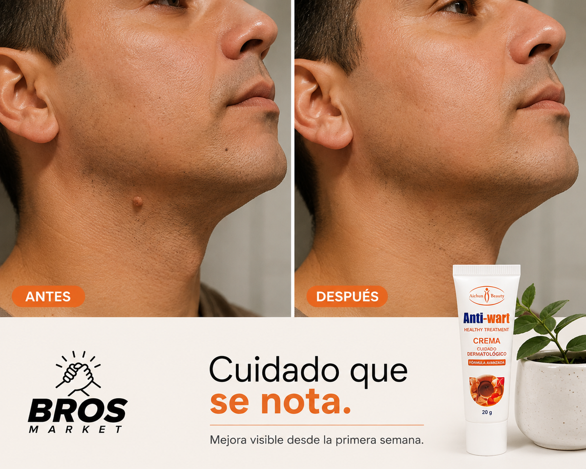 AntiWart Crema Anti Verrugas - Cuidado para una piel más uniforme