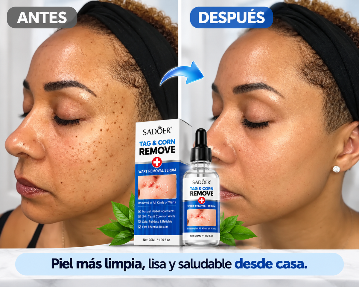 Sadoer ClearSkin Suero Reparador Removedor Verrugas - Para una piel de aspecto más uniforme